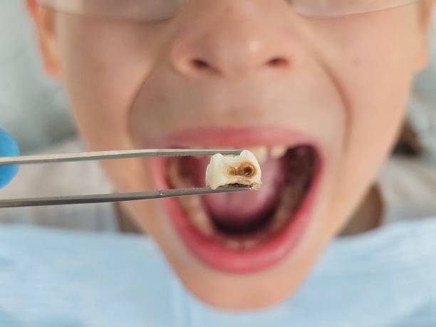 Best Emergency Orthodontic Repairs in Maurice, LA